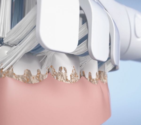 servizi_animazioni_3D_medicale_produzione_video